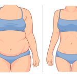Foto prima e dopo un percorso nutrizionale: sì o no? 6 foto prima e dopo