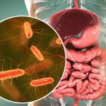 Disbiosi intestinale: cos'è, sintomi e come ristabilire l'equilibrio 2 disbiosi intestinale