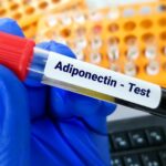 adinopectina
