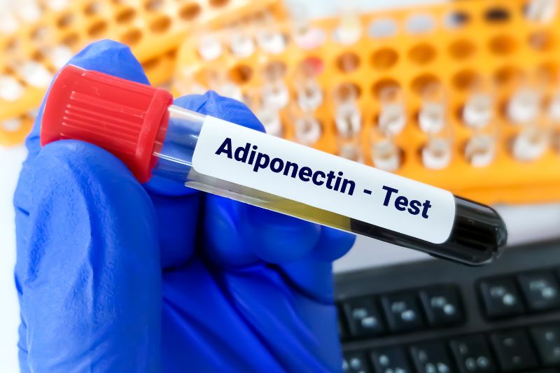 adinopectina